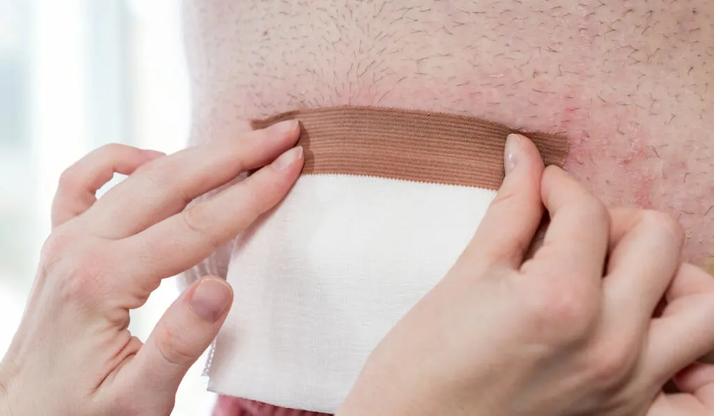 Nurse dressing the patient's wound